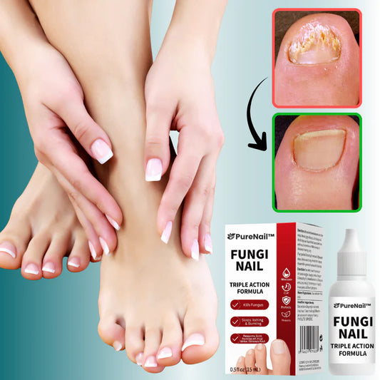 PureNail™ Neglesoppfjerner