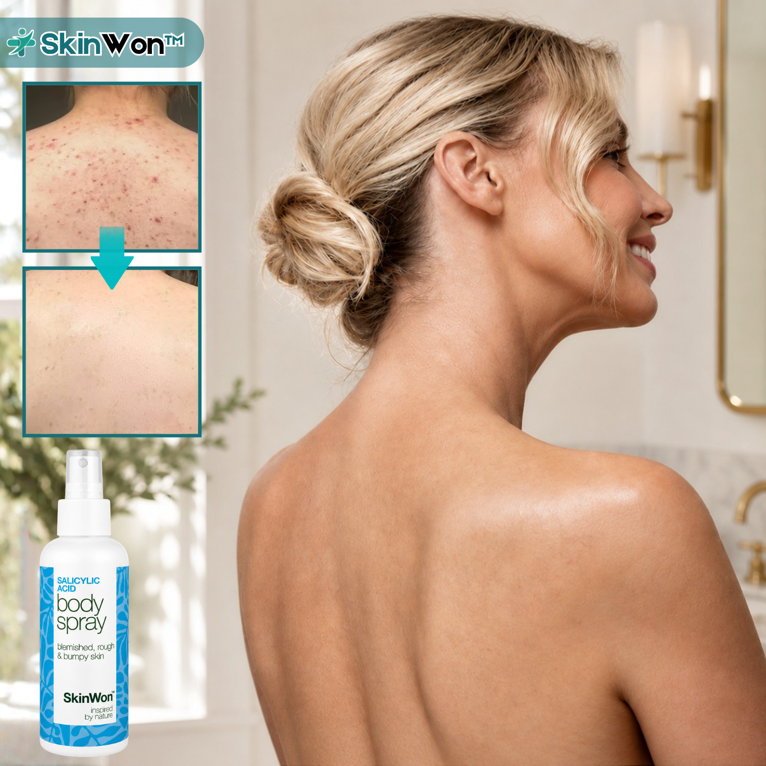 SkinWon™ Salisylsyre Kroppsspray