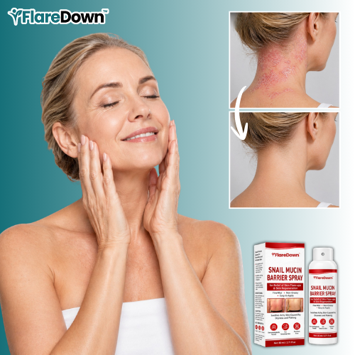 FlareDown™ Psoriasis Relief Spray