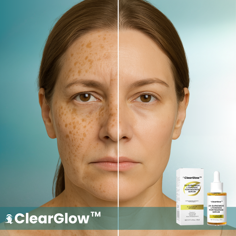 ClearGlow™  Anti-Blemish Serum