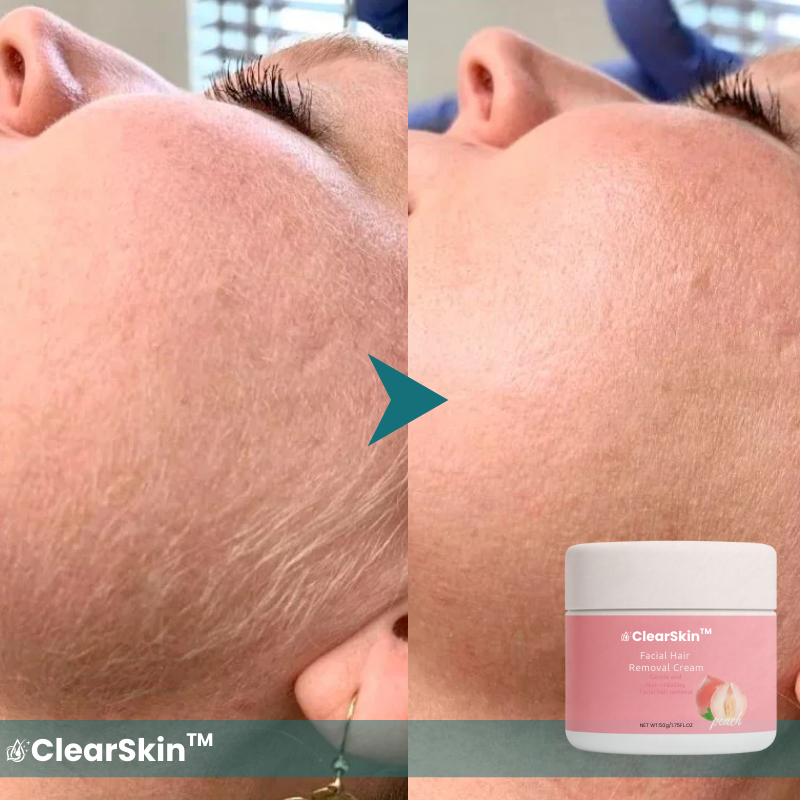 ClearSkin™ Ansiktshårvisker