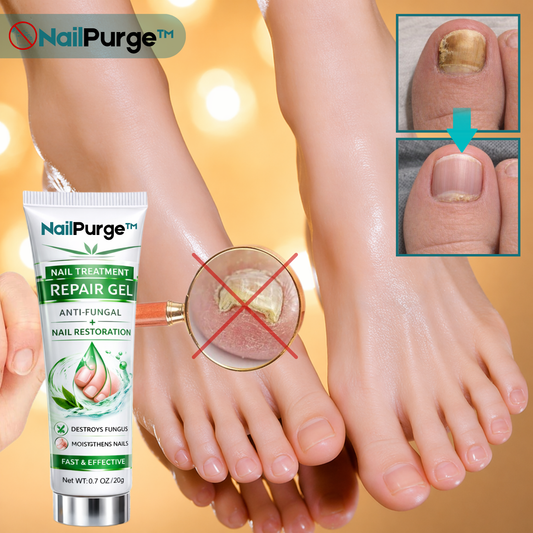 NailPurge™ Neglereparasjonsgel